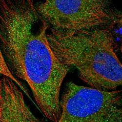 Invitrogen CCDC121 Polyclonal Antibody 100 &mu;L; Unconjugated:Antibodies,