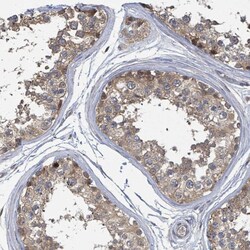 Invitrogen CCDC121 Polyclonal Antibody 100 &mu;L; Unconjugated:Antibodies,