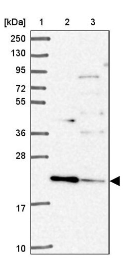 Invitrogen TMEM11 Polyclonal Antibody 100 &mu;L; Unconjugated:Antibodies,