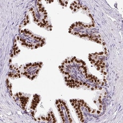Invitrogen C2orf71 Polyclonal Antibody 100 &mu;L; Unconjugated:Antibodies,
