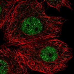 Invitrogen FAM65C Polyclonal Antibody 100 &mu;L; Unconjugated:Antibodies,