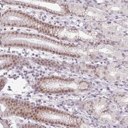 Invitrogen FAM65C Polyclonal Antibody 100 &mu;L; Unconjugated:Antibodies,