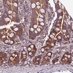 Invitrogen PAFAH1B2 Polyclonal Antibody 100 &mu;L; Unconjugated:Antibodies,