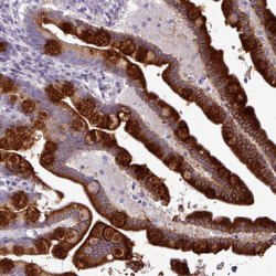 Invitrogen TOR1AIP2 Polyclonal Antibody 100 &mu;L; Unconjugated:Antibodies,