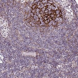 Invitrogen TMEM119 Polyclonal Antibody 100 &mu;L; Unconjugated:Antibodies,