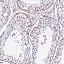 Invitrogen TMEM119 Polyclonal Antibody 100 &mu;L; Unconjugated:Antibodies,