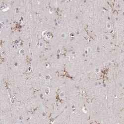 Invitrogen TMEM119 Polyclonal Antibody 100 &mu;L; Unconjugated:Antibodies,