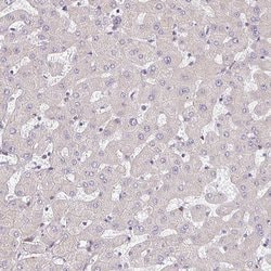 Invitrogen TMEM119 Polyclonal Antibody 100 &mu;L; Unconjugated:Antibodies,