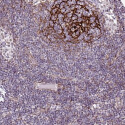Invitrogen TMEM119 Polyclonal Antibody 100 &mu;L | Buy Online | Invitrogen&trade; | Fisher Scientific
