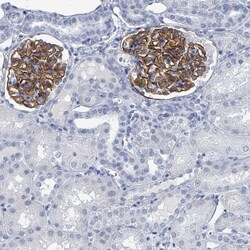 Invitrogen TAS2R1 Polyclonal Antibody 100 &mu;L; Unconjugated:Antibodies,