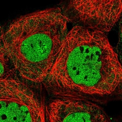 Invitrogen ALG8 Polyclonal Antibody 100 &mu;L | Buy Online | Invitrogen&trade; | Fisher Scientific