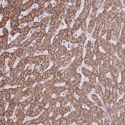 Invitrogen ALG8 Polyclonal Antibody 100 &mu;L | Buy Online | Invitrogen&trade; | Fisher Scientific