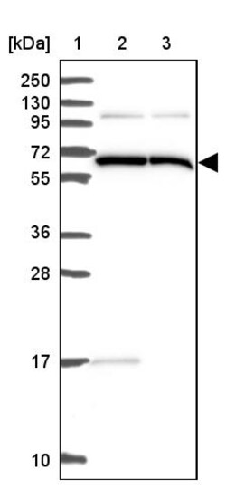 Invitrogen ALG8 Polyclonal Antibody 100 &mu;L | Buy Online | Invitrogen&trade; | Fisher Scientific