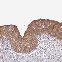 Invitrogen Ly-108 Polyclonal Antibody 100 &mu;L; Unconjugated:Antibodies,