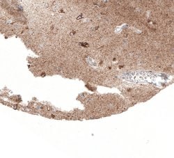 Invitrogen SERPINE3 Polyclonal Antibody 100 &mu;L; Unconjugated:Antibodies,