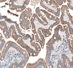 Invitrogen SERPINE3 Polyclonal Antibody 100 &mu;L; Unconjugated:Antibodies,