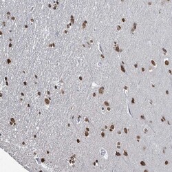 Invitrogen&trade;&nbsp;SAMD14 Polyclonal Antibody