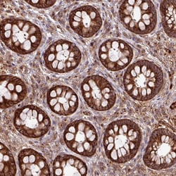 Invitrogen LSM12 Polyclonal Antibody 100 &mu;L; Unconjugated:Antibodies,