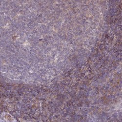 Invitrogen LRRC41 Polyclonal Antibody 100 &mu;L; Unconjugated:Antibodies,