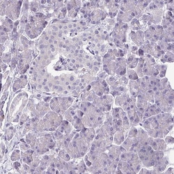 Invitrogen TMEM132A Polyclonal Antibody 100 &mu;L; Unconjugated:Antibodies,
