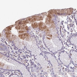 Invitrogen TMEM132A Polyclonal Antibody 100 &mu;L; Unconjugated:Antibodies,