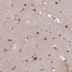 Invitrogen TMEM132A Polyclonal Antibody 100 &mu;L; Unconjugated:Antibodies,