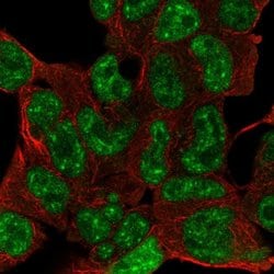 Invitrogen ESX1 Polyclonal Antibody 100 &mu;L; Unconjugated:Antibodies,