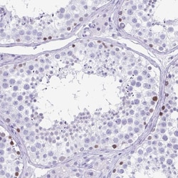 Invitrogen ESX1 Polyclonal Antibody 100 &mu;L; Unconjugated:Antibodies,