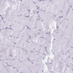 Invitrogen ESX1 Polyclonal Antibody 100 &mu;L; Unconjugated:Antibodies,