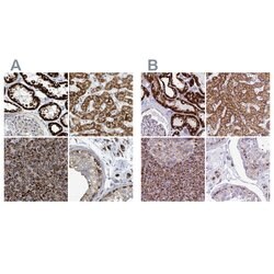 Invitrogen SUCLG2 Polyclonal Antibody 100 &mu;L | Buy Online | Invitrogen&trade; | Fisher Scientific