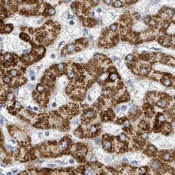 Invitrogen SUCLG2 Polyclonal Antibody 100 &mu;L | Buy Online | Invitrogen&trade; | Fisher Scientific
