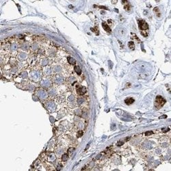 Invitrogen SUCLG2 Polyclonal Antibody 100 &mu;L | Buy Online | Invitrogen&trade; | Fisher Scientific
