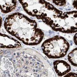 Invitrogen SUCLG2 Polyclonal Antibody 100 &mu;L | Buy Online | Invitrogen&trade; | Fisher Scientific