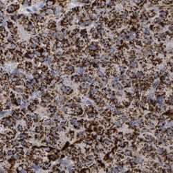 Invitrogen SUCLG2 Polyclonal Antibody 100 &mu;L | Buy Online | Invitrogen&trade; | Fisher Scientific