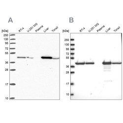 Invitrogen SUCLG2 Polyclonal Antibody 100 &mu;L | Buy Online | Invitrogen&trade; | Fisher Scientific