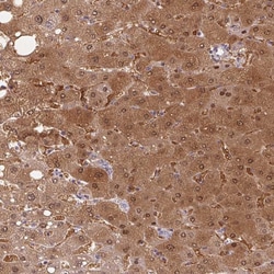 Invitrogen Protein Z Polyclonal Antibody 100 &mu;L; Unconjugated:Antibodies,