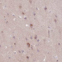 Invitrogen GEFT Polyclonal Antibody 100 &mu;L; Unconjugated:Antibodies,