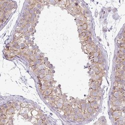 Invitrogen PNLDC1 Polyclonal Antibody 100 &mu;L; Unconjugated:Antibodies,