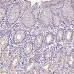 Invitrogen PNLDC1 Polyclonal Antibody 100 &mu;L; Unconjugated:Antibodies,