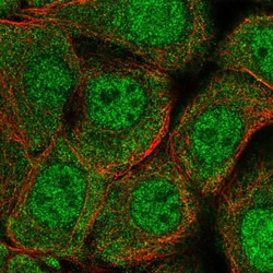 Invitrogen SWI5 Polyclonal Antibody 100 &mu;L; Unconjugated:Antibodies,