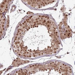 Invitrogen SWI5 Polyclonal Antibody 100 &mu;L; Unconjugated:Antibodies,