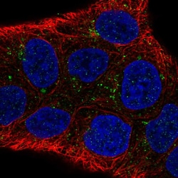 Invitrogen DAB1 Polyclonal Antibody 100 &mu;L | Buy Online | Invitrogen&trade; | Fisher Scientific