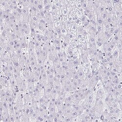 Invitrogen DAB1 Polyclonal Antibody 100 &mu;L | Buy Online | Invitrogen&trade; | Fisher Scientific