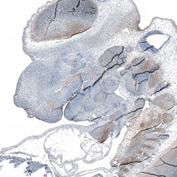 Invitrogen DAB1 Polyclonal Antibody 100 &mu;L | Buy Online | Invitrogen&trade; | Fisher Scientific