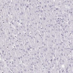 Invitrogen DAB1 Polyclonal Antibody 100 &mu;L | Buy Online | Invitrogen&trade; | Fisher Scientific