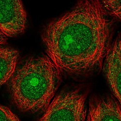 Invitrogen ZNF354A Polyclonal Antibody 100 &mu;L; Unconjugated:Antibodies,