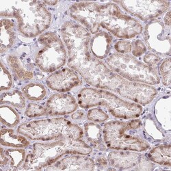 Invitrogen ZNF354A Polyclonal Antibody 100 &mu;L; Unconjugated:Antibodies,