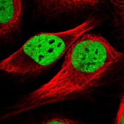 Invitrogen TAF15 Polyclonal Antibody 100 &mu;L; Unconjugated:Antibodies,