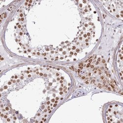 Invitrogen TAF15 Polyclonal Antibody 100 &mu;L; Unconjugated:Antibodies,