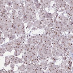 Invitrogen TAF15 Polyclonal Antibody 100 &mu;L; Unconjugated:Antibodies,